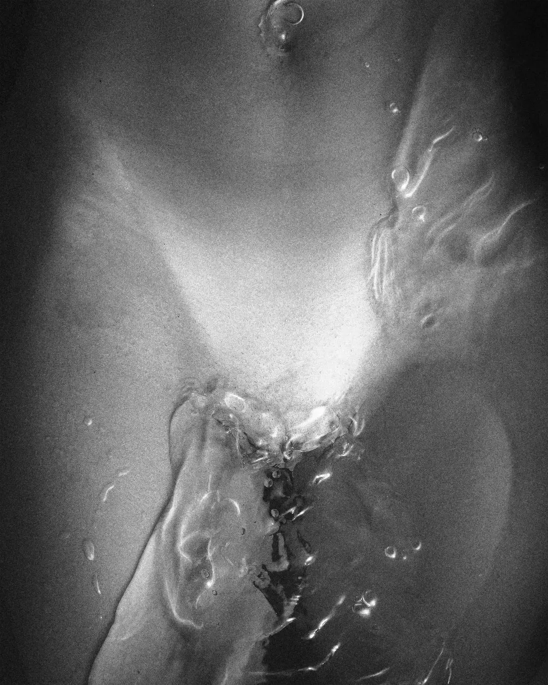 Unformed